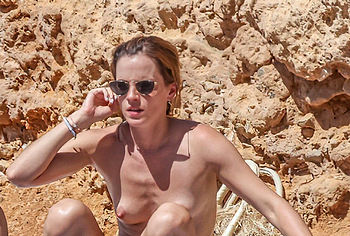 Emma Watson exposed