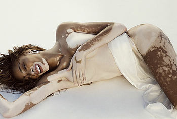 Winnie Harlow Nude And Hot See Through Pics