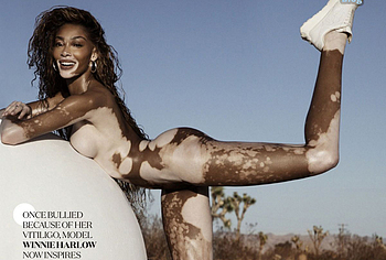 Winnie Harlow Nude And Hot See Through Pics
