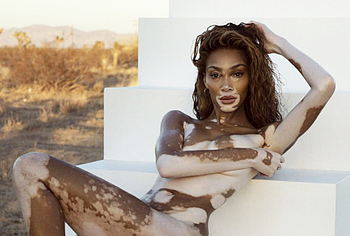 Winnie Harlow Nude And Hot See Through Pics