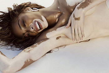 Winnie Harlow Nude And Hot See Through Pics