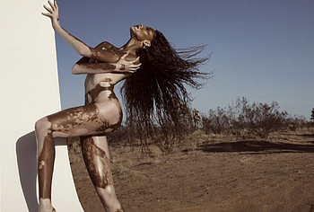 Winnie Harlow nudity